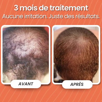 Protocole Repousse 90 Jours