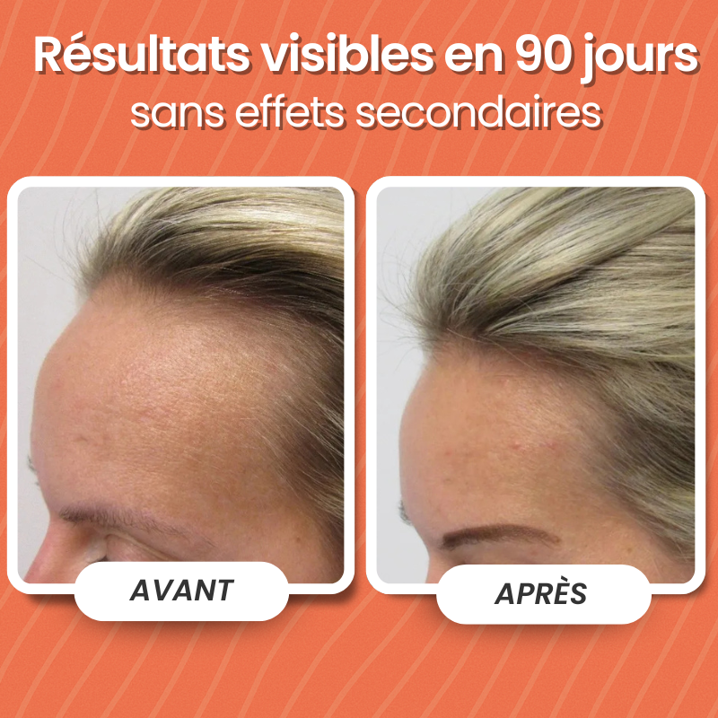 Protocole Repousse 90 Jours