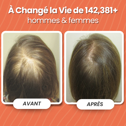 Protocole Repousse 90 Jours