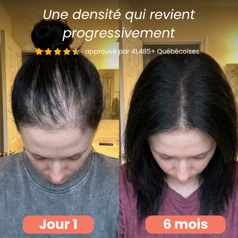 Programme Anti-chute et Repousse